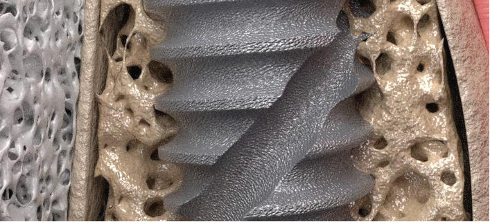 From microstructure to macro stability.