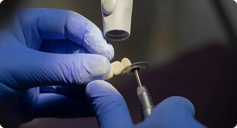 Effect of Cold Atmospheric Plasma on Cell Adhesion in Dental Implants